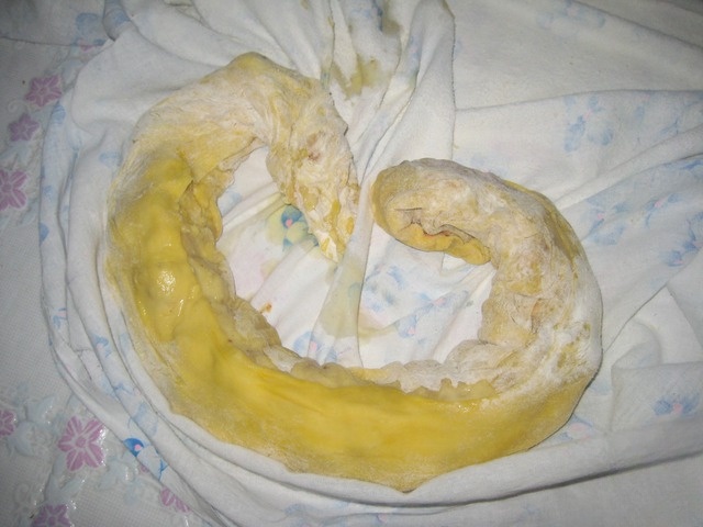 step-8